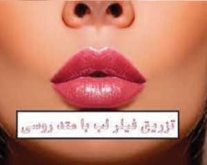 تزریق ژل لب روسی کرج