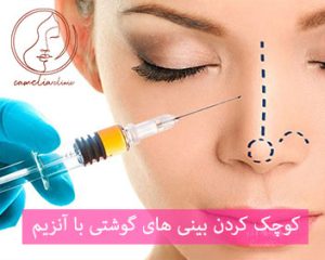 كوچك كردن بيني با آنزيم كرج