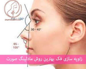 قیمت زاویه فک در کلینیک گلشهر کرج