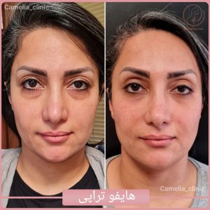 هایفوتراپی-کلینیک کاملیا گلشهر کرج-2