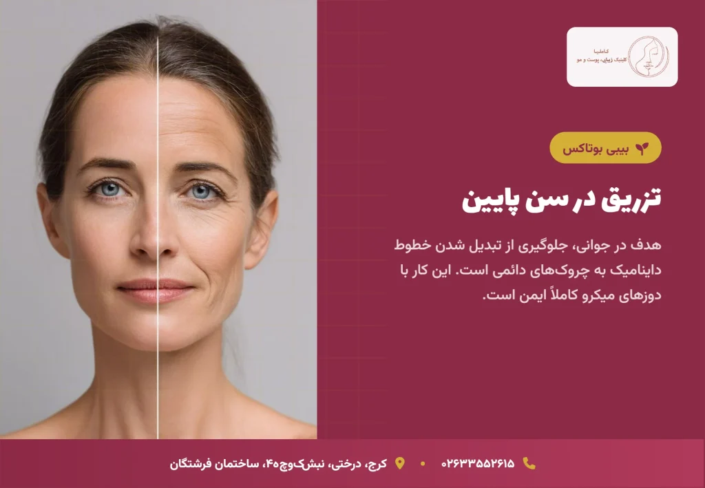 تکنیک بیبی بوتاکس: عوارض بوتاکس در جوانی